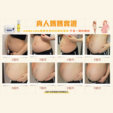 防妊娠紋滋潤油
